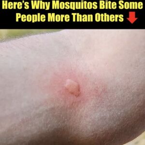 Here’s Why Mosquitos Bite Some People More Than Others