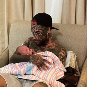 A 24-year-old father, who has several tattoos all over his body, makes the decision to get them erased for his child