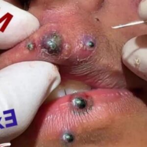Seven Things That Clog Your Pores Seven Things That Clog Your Pores