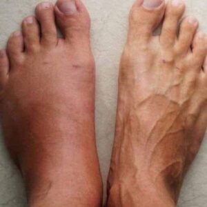 One month before a heart att.ack, your body will send you of these 6 signs One month before a heart att.ack, your body will send you of these 6 signs