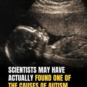 Study identifies possible connection to Study identifies possible connection to