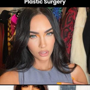 These Celebs Accept Publicly They Have Had Plastic Surgery These Celebs Accept Publicly They Have Had Plastic Surgery