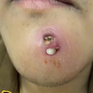 What Causes this What Causes this