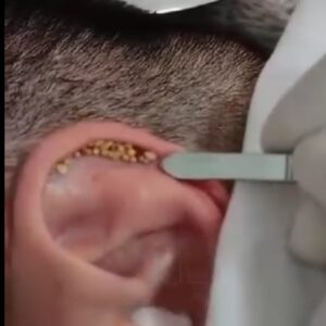 Signs and Prevention Tips for a Adult Ear Infections Signs and Prevention Tips for a Adult Ear Infections