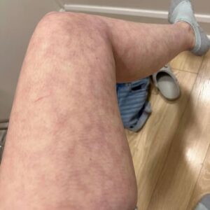 These are the consequences of sleeping with…See more These are the consequences of sleeping with…See more