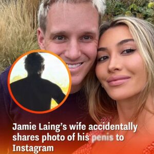 Jamie Laing’s wife accidentally shares photo of his penis to Instagram Jamie Laing’s wife accidentally shares photo of his penis to Instagram